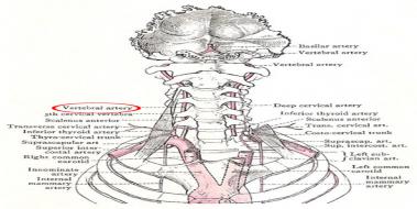 Vertebral Arter